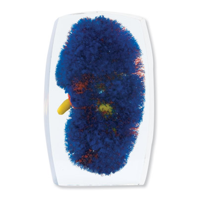 ��Ѫ��ģ�ͣ�������������